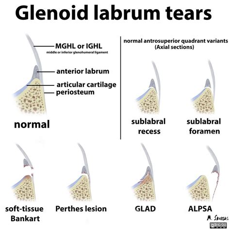 Pin on Medical Illustrations