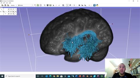 The anatomy of the arcuate fasciculus using diffusion MRI data - YouTube