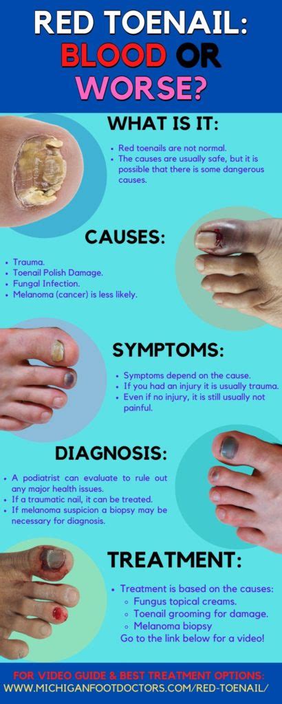 Red Spot Under Toenail [Causes, Home Remedies & Best Treatment]