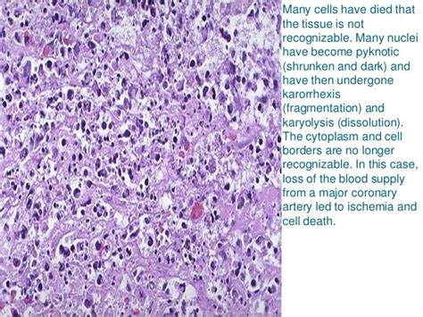 Basic Pathology lab slides