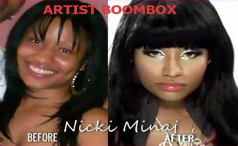 Nicki Minaj Before Fame | Nicki minaj before fame pictures 1 | Celebrity plastic surgery, Mommy ...