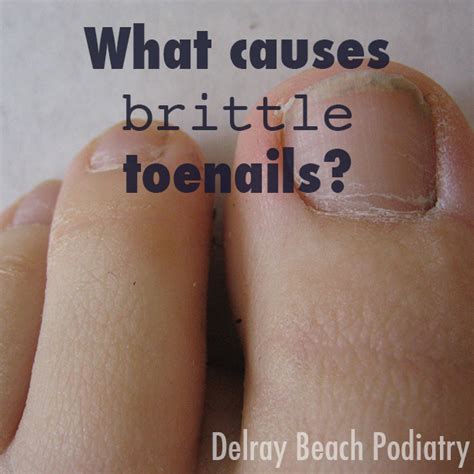 What causes brittle toenails? - Delray Beach Podiatry