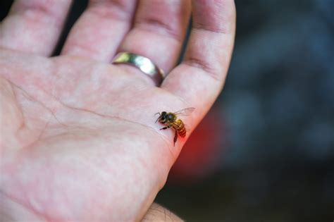 How to Treat Wasp Sting? - Wemogee.com