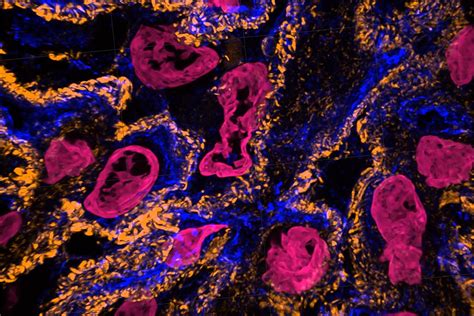 Unprecedented Views of Cell Interiors With New Expansion Microscopy Methods