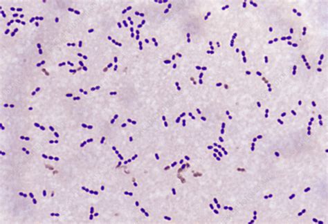 Strep Pneumoniae Gram Stain Morphology