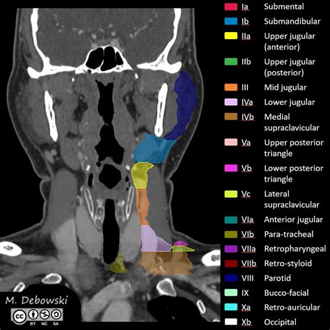 Cervical Lymph Nodes Radiopaedia | Images and Photos finder