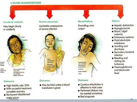 Malaria