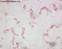 Salmonella Images - Infectious Disease Images - eMicrobes Digital ...