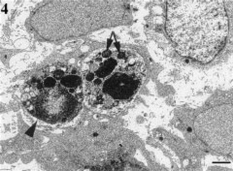 Transmission electron microscopy of apoptotic cells within the basement... | Download Scientific ...