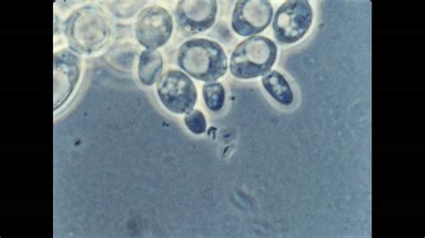 Yeast Cell Under Microscope