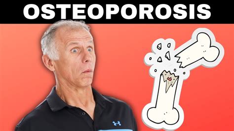 10 Best Exercises for Osteoporosis "Weak or Thinning Bones". - YouTube