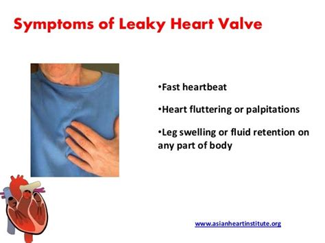 Asian Heart Institute - Leaky heart valve symptoms