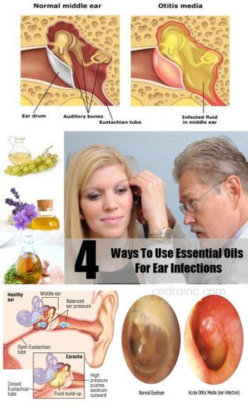 ear infection treatment with essential oils - Philadelphia Holistic Clinic