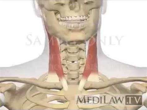 Function of Sternocleidomastoid (SCM) muscle. - YouTube