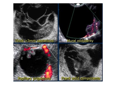 Basic gynae ultrasound