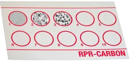 RPR Test: Principle, Procedure, Interpretations • Microbe Online