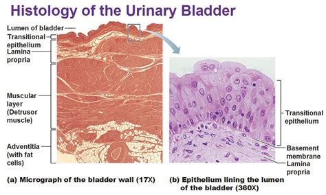 histology of urinary bladder, transitional epithelium, muscular layer, detrusor, adventitia ...