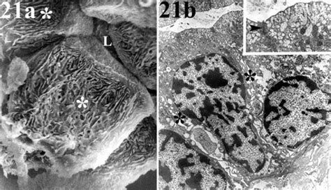 Microanatomy and ultrastructure of the kidney of the African lungfish ...