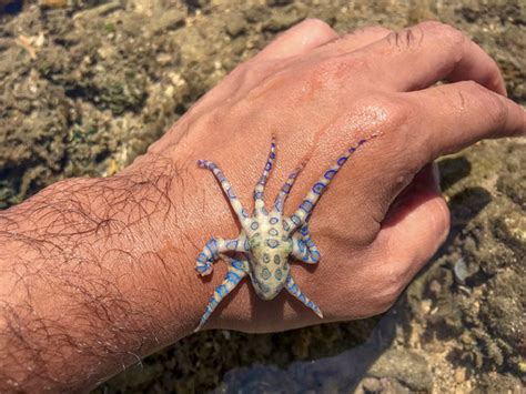 Blue-Ringed Octopus Bite Symptoms and Emergency First Aid