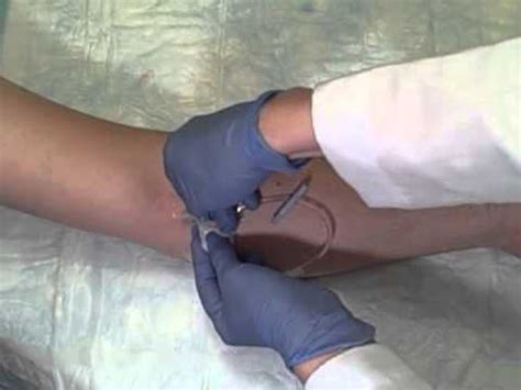 Intravenous (IV) Catheter Removal - YouTube