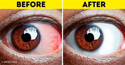 8 Exercises All People With Tired Eyes Need to Do | Exercício para os olhos, Olhos cansados ...