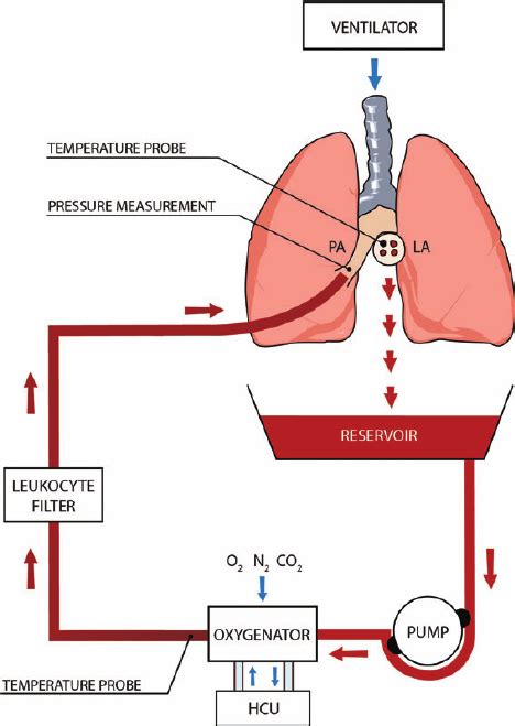 Line diagram of an ex vivo lung perfusion (EVLP) circuit. PA, pulmonary ...