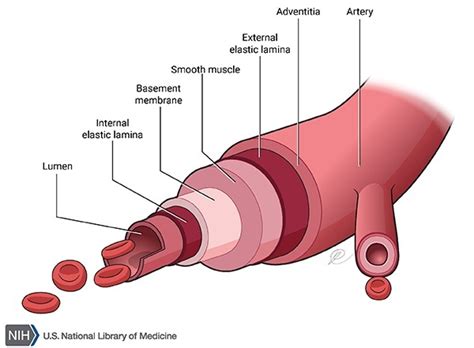 Parkes Weber syndrome: MedlinePlus Genetics