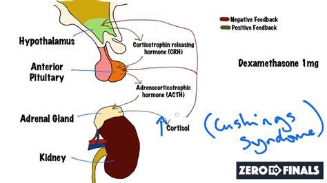 Understanding The Dexamethasone Suppression Test - YouTube