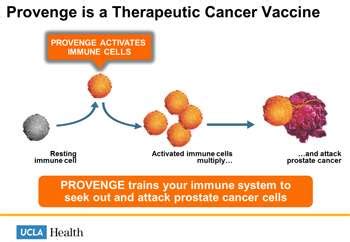 Provenge Advanced Prostate Cancer Treatment | UCLA Health Jonsson Comprehensive Cancer Center