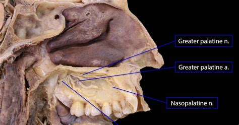 Pterygopalatine Fossa and Palate 18.JPG - Google Drive