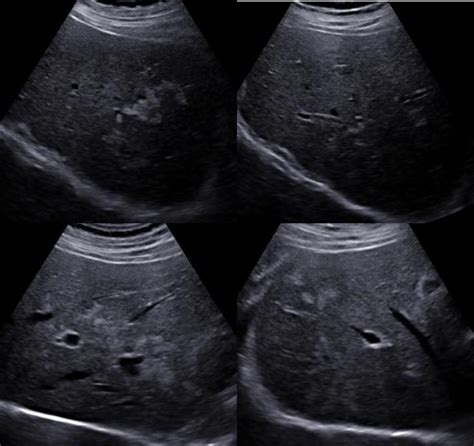 July 2018 | Ultrasound Cases