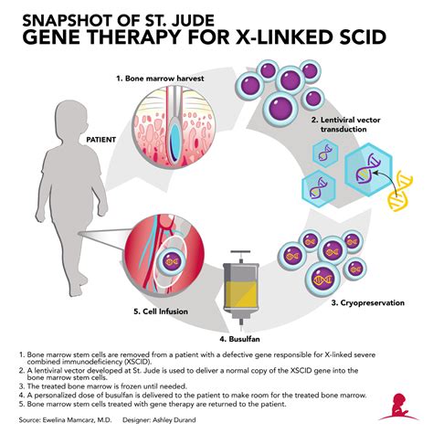 St. Jude gene therapy improves immunity in babies with ‘bubble boy’ disease