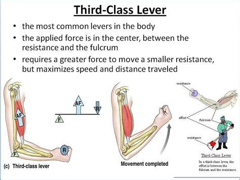 First Class Lever Triceps