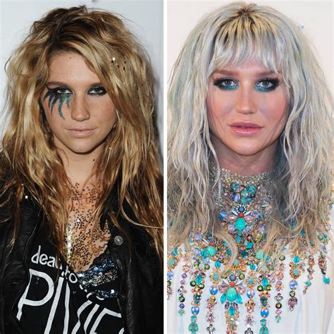 The Beauty Evolution of Kesha: From Glitter Goddess to Hair Color Quee | Teen Vogue