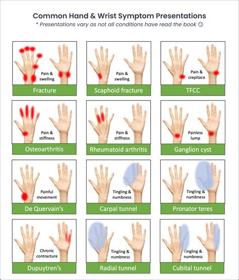 Chiropractic Hand And Wrist Physical Exam — ChiroUp | Muscle spasms relief, Medical school stuff ...