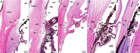 16 Normal iridocorneal angle microscopic anatomy of commonly used... | Download Scientific Diagram