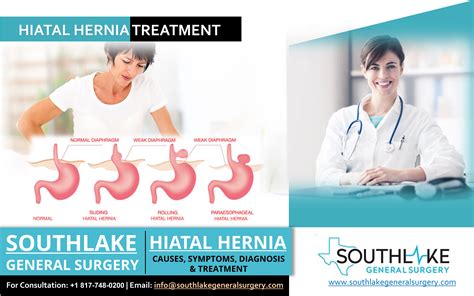 Hiatal Hernia Treatment at Southlake General Surgery, Texas - Southlake ...