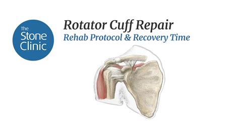 Supraspinatus Tear Recovery Time