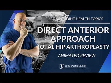 Direct Anterior Approach Hip Replacement (anatomy animation) - YouTube