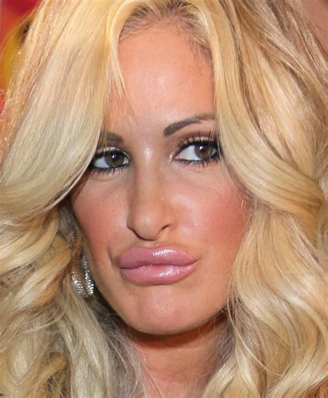 Kim Zolciak Plastic Surgery