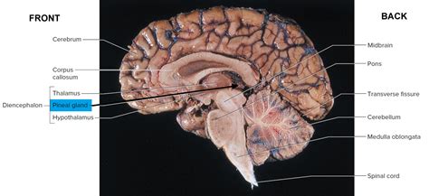 Pineal Gland & its Function - Cyst & Calcified Pineal Gland