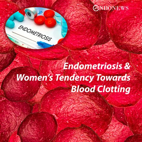 Endometriosis and Women’s Tendency Towards Blood Clotting | EndoNews