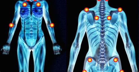 10 Most Overlooked Causes of Fibromyalgia | DailyHealthPost