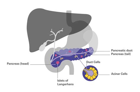 Types of pancreatic cancer - Pancreatic Cancer UK