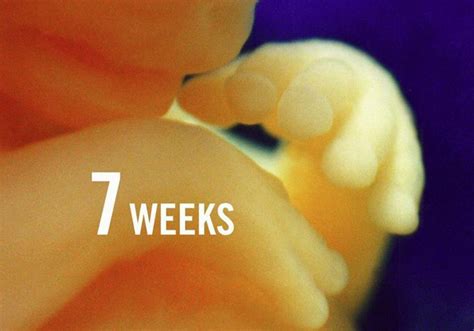 Photo of an unborn child at 7 weeks | Fetal Development | Pinterest ...