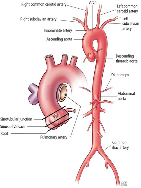 Aortic replacement in cardiac surgery ... | Medical knowledge, Pharmacology nursing, Medical ...