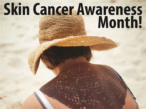 The OACHC Informer: Skin Cancer Prevention