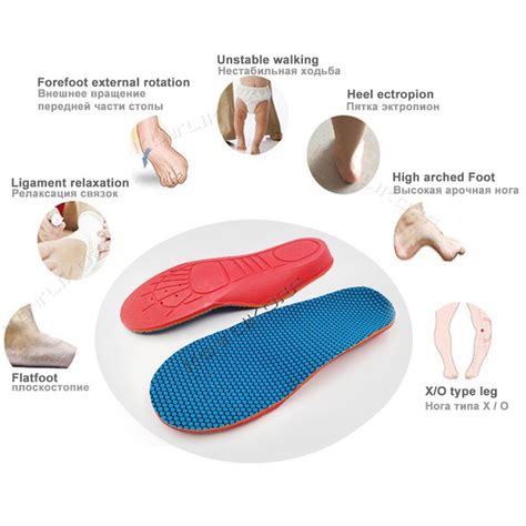 obtener Disciplina Medición plantillas para pie cavo giro Escultura Contribución