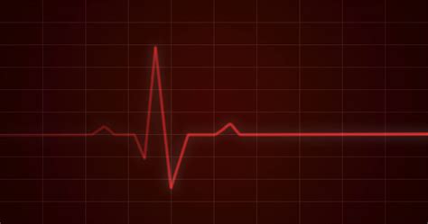 Free photo: Heartbeat Monitor Concept - Molded, Pulse, Procedure - Free Download - Jooinn