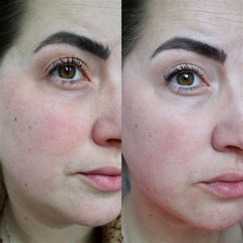 Olay Retinol24 Review: I used It everyday for over 30 days, these are my results | Northern ...